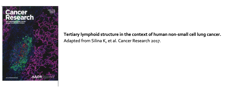 Tertiary lymphoid structures in cancer
