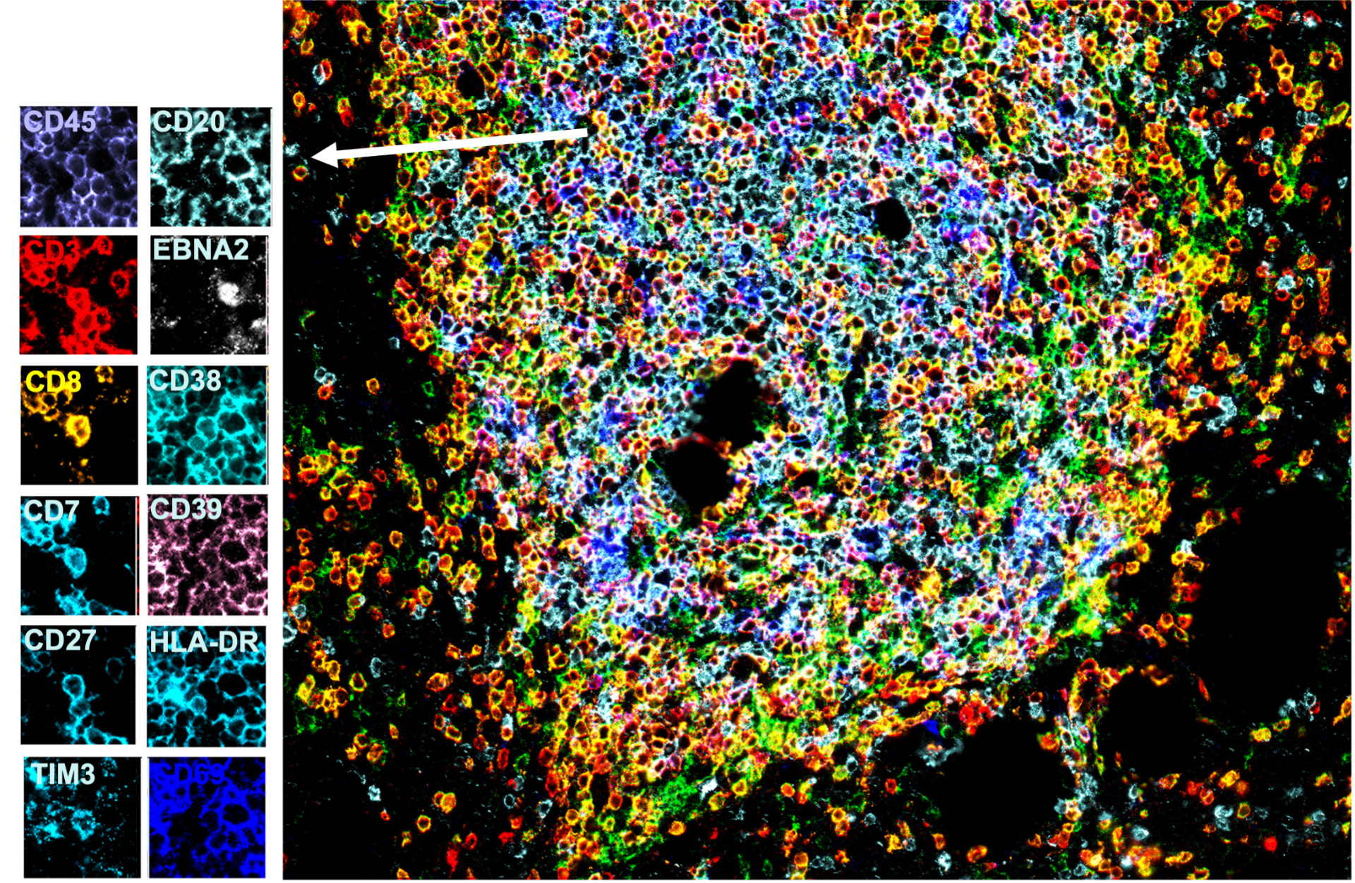 Aspects of mostly asymptomatic coexistence of EBV and KSHV with humans
